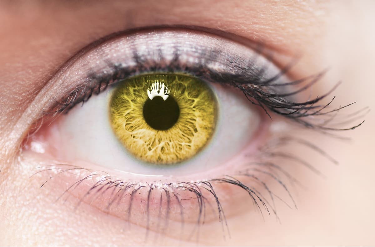 Yellow Spot Disease (Macular Degeneration) - Özel Karşıyaka Göz Hastanesi